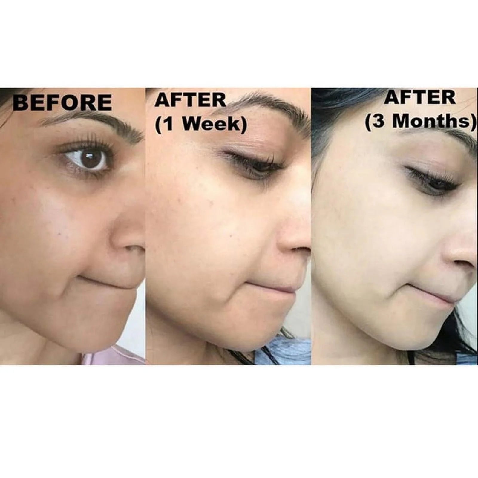 Kojic Acid Soap with Coconut & Tea Tree Oil, Skin Tone Bar, 65G, 2-Pack